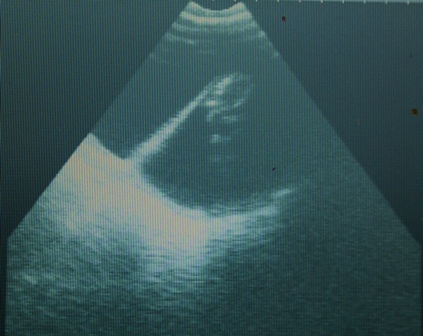 Alpaca Pregnanacy Scanning at Oak ViewAlpacas